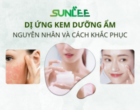 Lí do dị ứng kem dưỡng ẩm và cách khắc phục