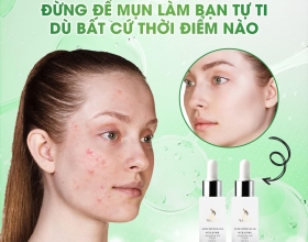 Có nên sử dụng tế bào gốc trị mụn hay không?