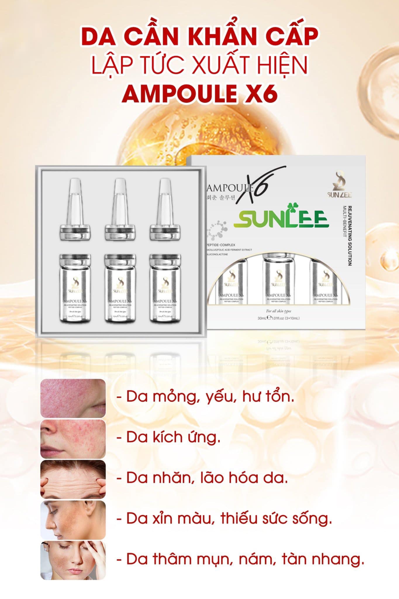 TRỊ MỤN SUNLEE