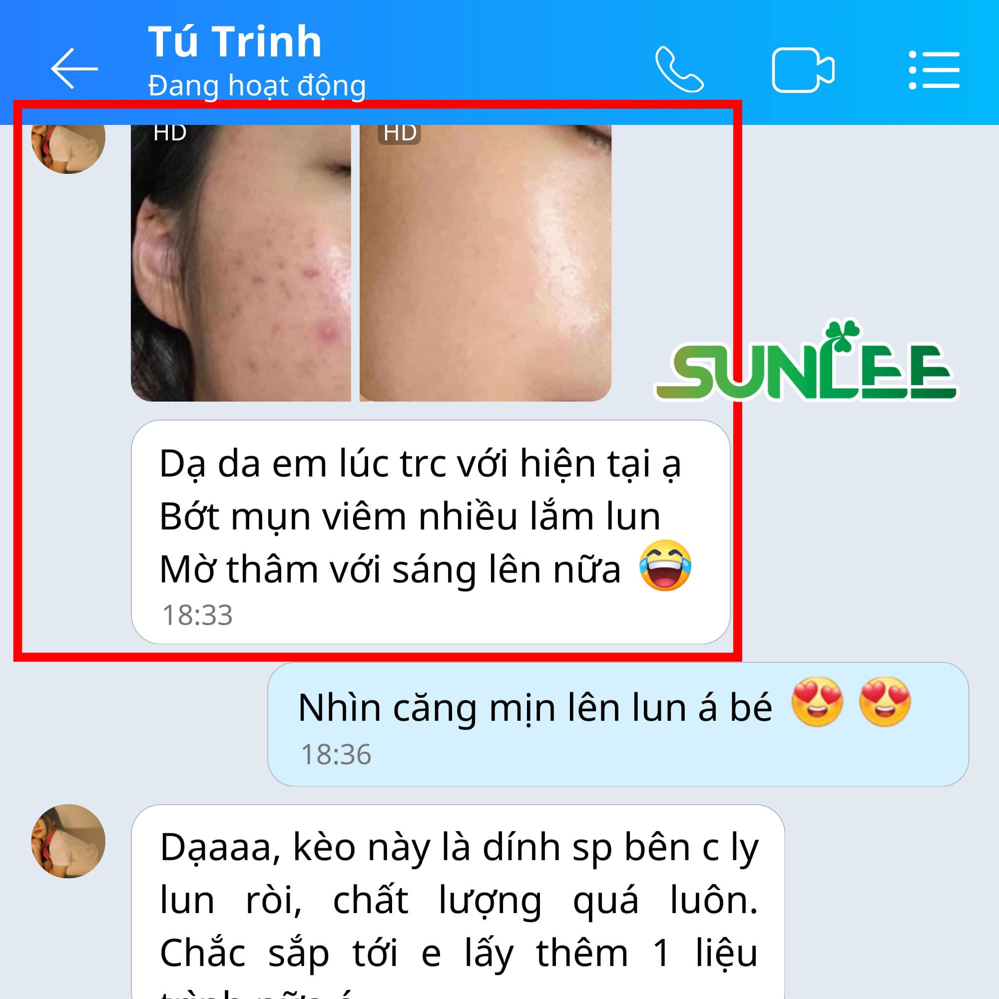 TRỊ MỤN SUNLEE