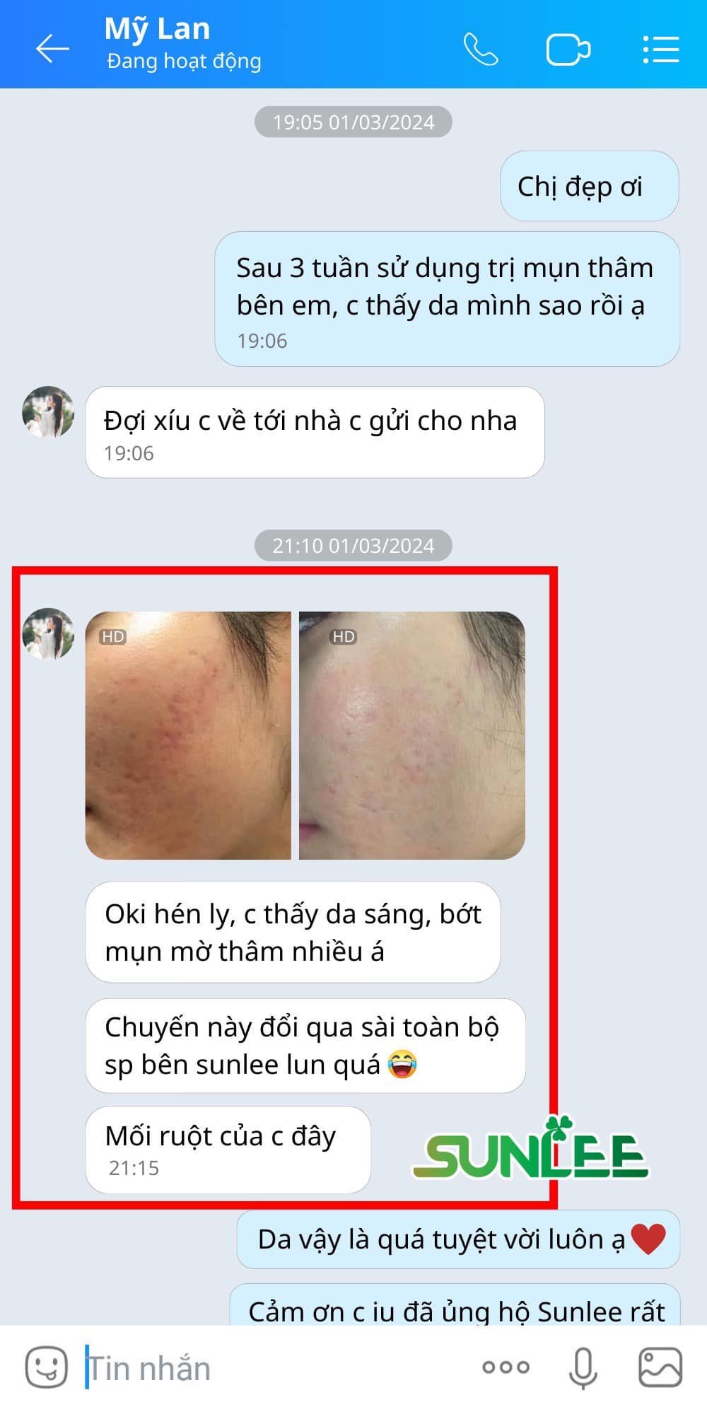 TRỊ MỤN SUNLEE