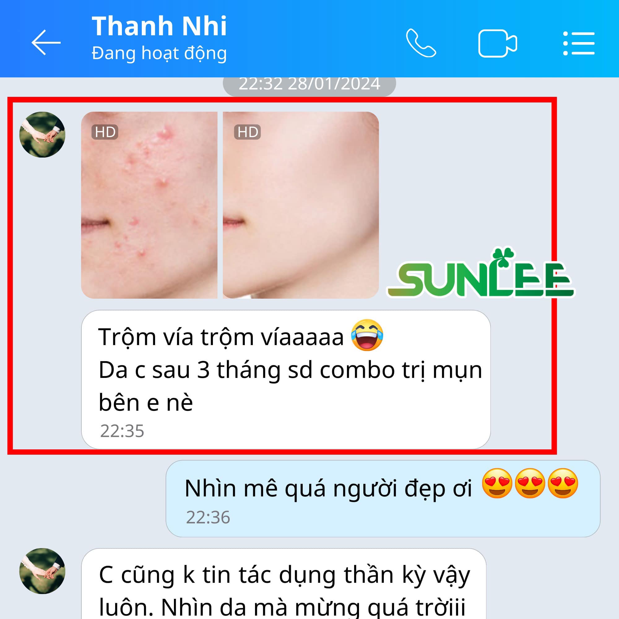 TRỊ MỤN SUNLEE